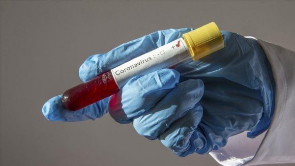 ÜST: Dünyada koronavirusa yoluxanların sayı 463 mindən çox artıb