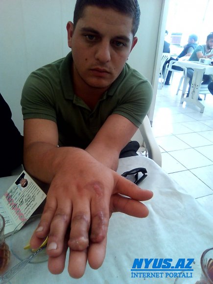 Müdafiə Nazirinə bu hadisə haqda məlumat verilmir
