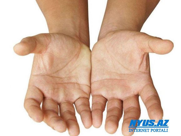 Əllərin əsməsi bu xəstəliyin ilk simptomudur - HƏKİM RƏYİ