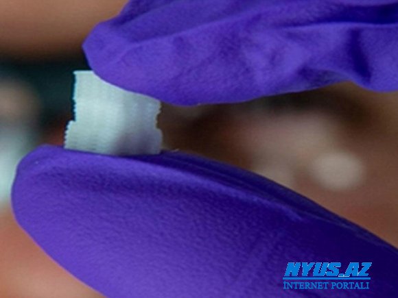 Ən mürəkkəb toxumalardan birinin 3D implantı hazırlanıb