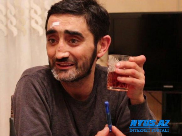 3 yaşlı Aydın Xırdalanlı - FOTO