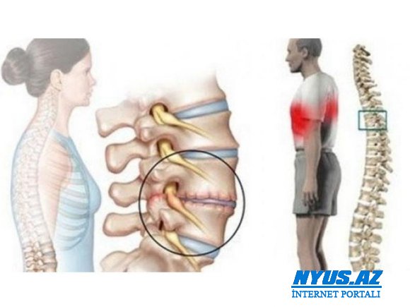 İnsanı cavan saxlayan SİRR və Pilates haqda ilk dəfə oxuyacağınız İNANILMAZ FAKTLAR