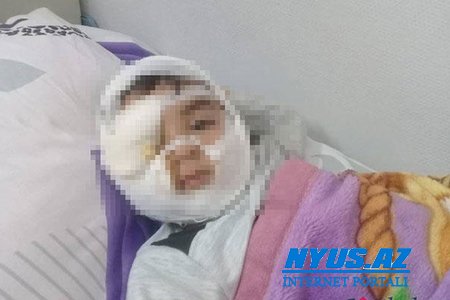 Üzü parçalanan uşağın atası: “Sulutəpədə sahibsiz itlərin sayı həddindən artıq çoxdur”