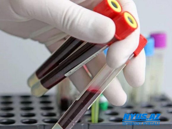 Xərçəng müayinəsində yeni QAN ANALİZİ - Yaxın illərdə biopsiya olmayacaq