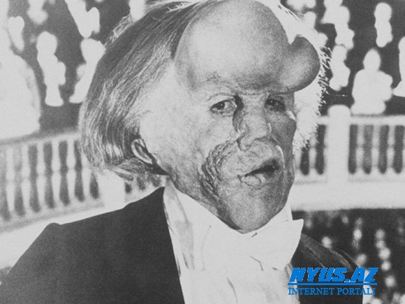 Jozef Merrickin məzarı ölümündən 130 il sonra tapıldı
