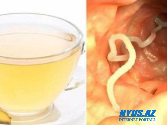 Vücudunuzdakı parazitləri MƏHV EDƏN MÖCÜZƏVİ ÇAY