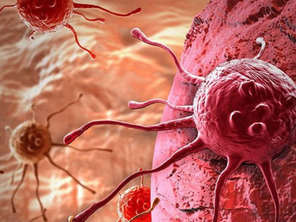 Talış zonasında yaşayanların xərçəngə tutulması ilə bağlı maraqlı FAKT