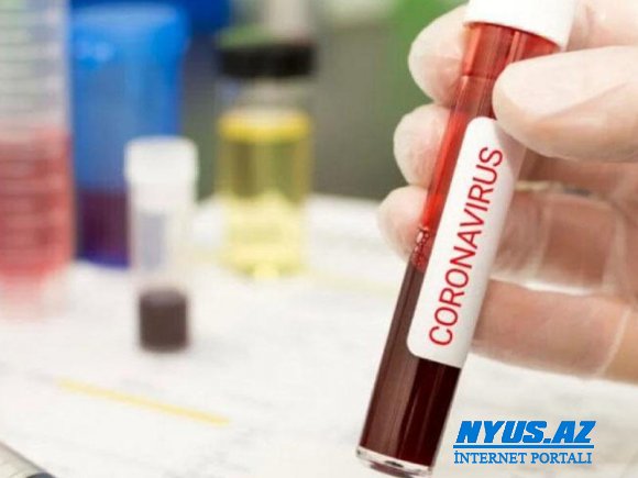 Azərbaycanda daha 101 nəfərdə koronavirus aşkarlanıb - 1 nəfər vəfat edib, 53 nəfər sağalıb