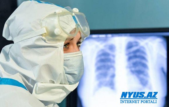 Moskvada son sutka koronavirusdan 76 nəfər dünyasını dəyişib