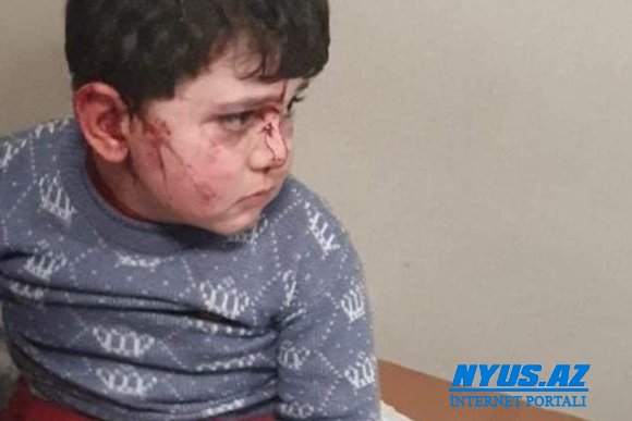 "Ermənistan məğlubiyyətin heyfini dinc sakinlərdən çıxmağa çalışır" - FOTO