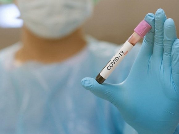 Azərbaycan alimləri COVID-19-un yayılmasını izləmək üçün model təklif ediblər