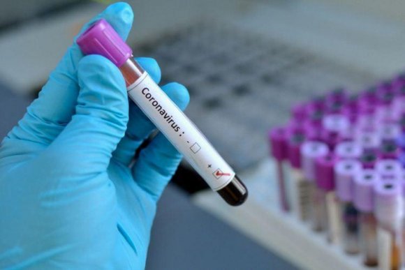 Dünyada 100 milyondan çox insan koronavirusa yoluxub