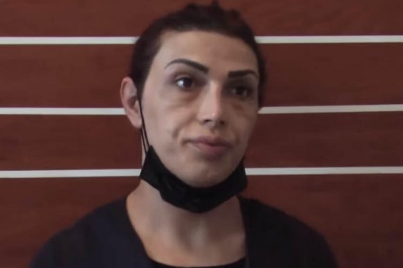 "Gözəlçə" Aydın bıçaq çıxardı, sürücünü soydu