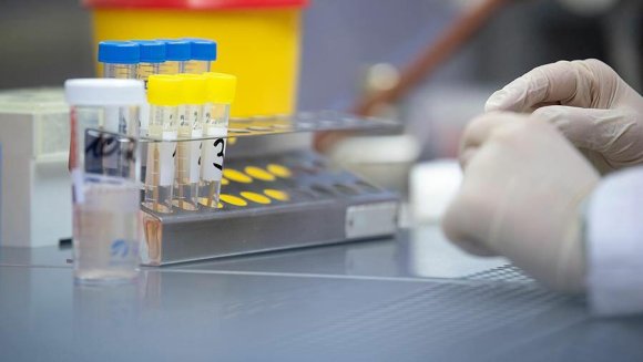 Xorvatiyada "omikron"un yeni variantları aşkarlanıb