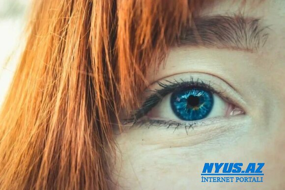 Gözlərdə yüksək xolesterol səviyyəsini necə təyin etmək olar? - Oftalmoloqdan AÇIQLAMA