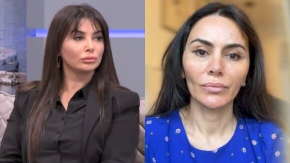 “Ülviyyə İlyasova, sən qanundan üstünsən” - Qənirə Ataşova qadın cərrahı “bitirdi”